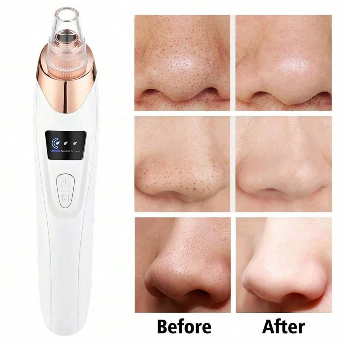 Facial Pore Vacuum Cleanser – USB Rechargeable Blackhead & Pore Suction Tool for Deep Cleansing and Gentle Exfoliation