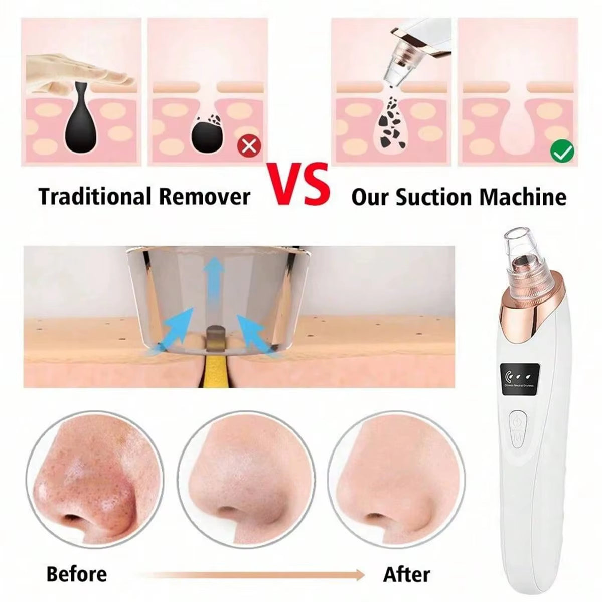 Facial Pore Vacuum Cleanser – USB Rechargeable Blackhead & Pore Suction Tool for Deep Cleansing and Gentle Exfoliation